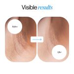 رول زیر بغل 4% AHA BHA از برند Bodywise با رایحه Flora - تصویر 2